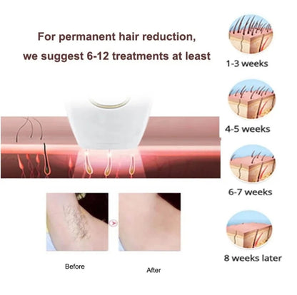 IPL Laser Hair Removal Handset System for Women & Men with Razor & Safety Glasses